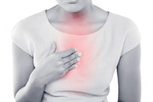 What Is Acid Reflux?